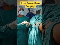 Live femur bone surgery  femur bonefracture bonepain orthopedicdoctor mbbs medicalstudents 