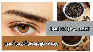 احصلي على نظارة العينين و تخلصي من الهالات السوداء بأسهل الوصفات الطبيعية.  | اقل من أسبوع !!!