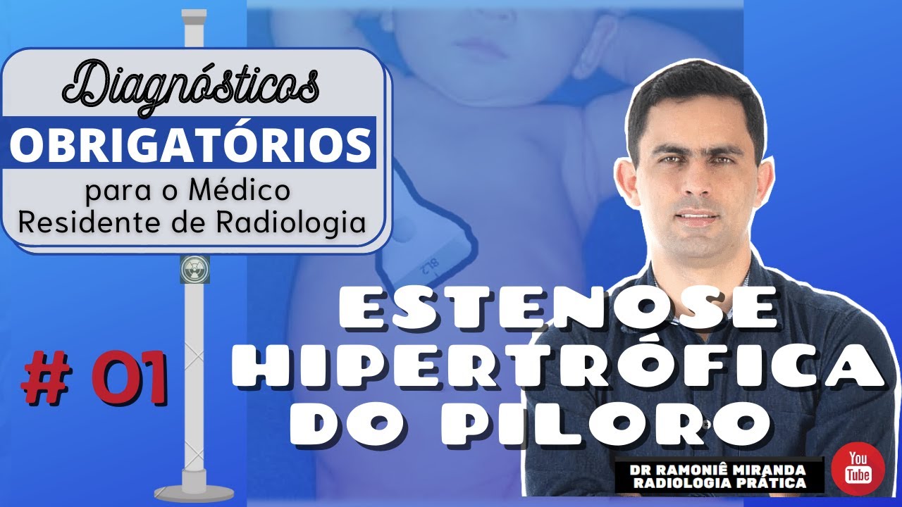 Sinal De Estenose Pilorica A Estenose Hipertrófica Do Piloro (EHP) é