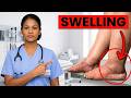 The #1 VITAMIN Seniors Over 60 Need To Help Reduce SWOLLEN LEGS AND ANKLES
