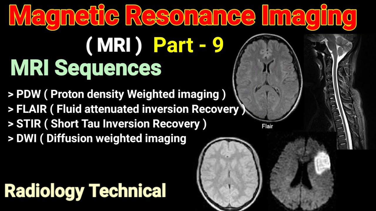 MRI Part 9 MRI Sequences PDW FLAIR STIR DWI Sequences MRI Part 9 MRI Sequences PDW FLAIR STIR DWI Sequences
