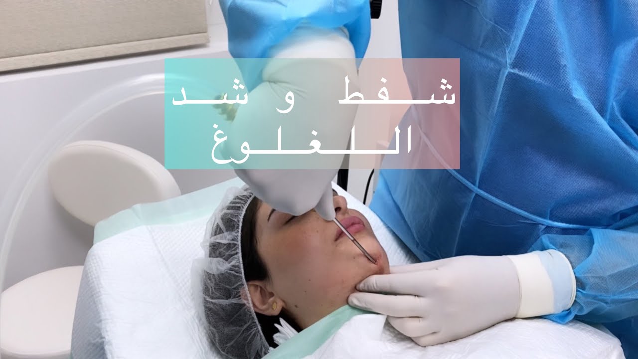 شفطت و شديت بدون جراحة !!