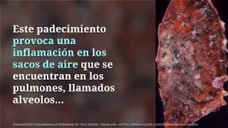 Neumonía: causas, síntomas y tratamiento - Meditip Neumonía: causas, síntomas y tratamiento - Meditip