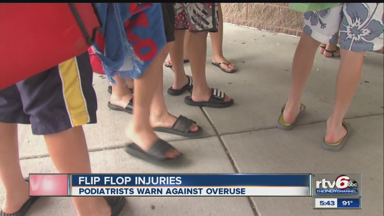 Experts warn against wearing flip-flops 