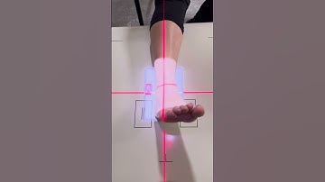Ankle X Ray Positioning