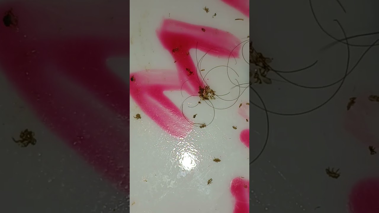 Minha gente, olha esses piolhos o pipoco que dá!