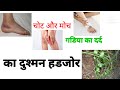 हडजोड की पहचान// benifits of cissus quadrangular is// चोट मोच और अस्थिभंग का रामबाण औषधि नुस्खा