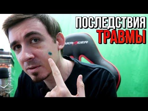 Видео: ХРУСТ КОСТЕЙ: Последствия травмы