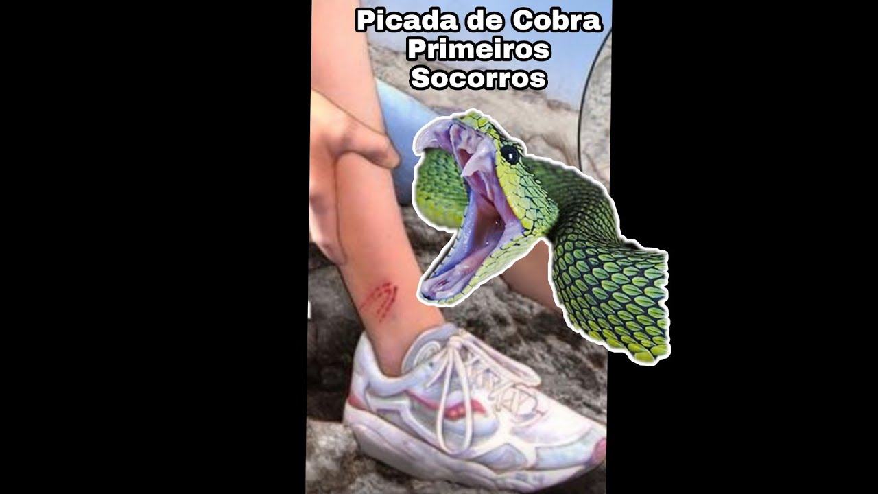 Picada de Cobra, O Que Fazer? | Vídeos Curtos | Biólogo Henrique