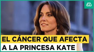 Kate Middleton revela que tiene cáncer: Princesa de Gales está con quimioterapia