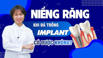 Niềng Răng Khi Đã Trồng Implant Có Được Không | Nam Bùi Vinalign