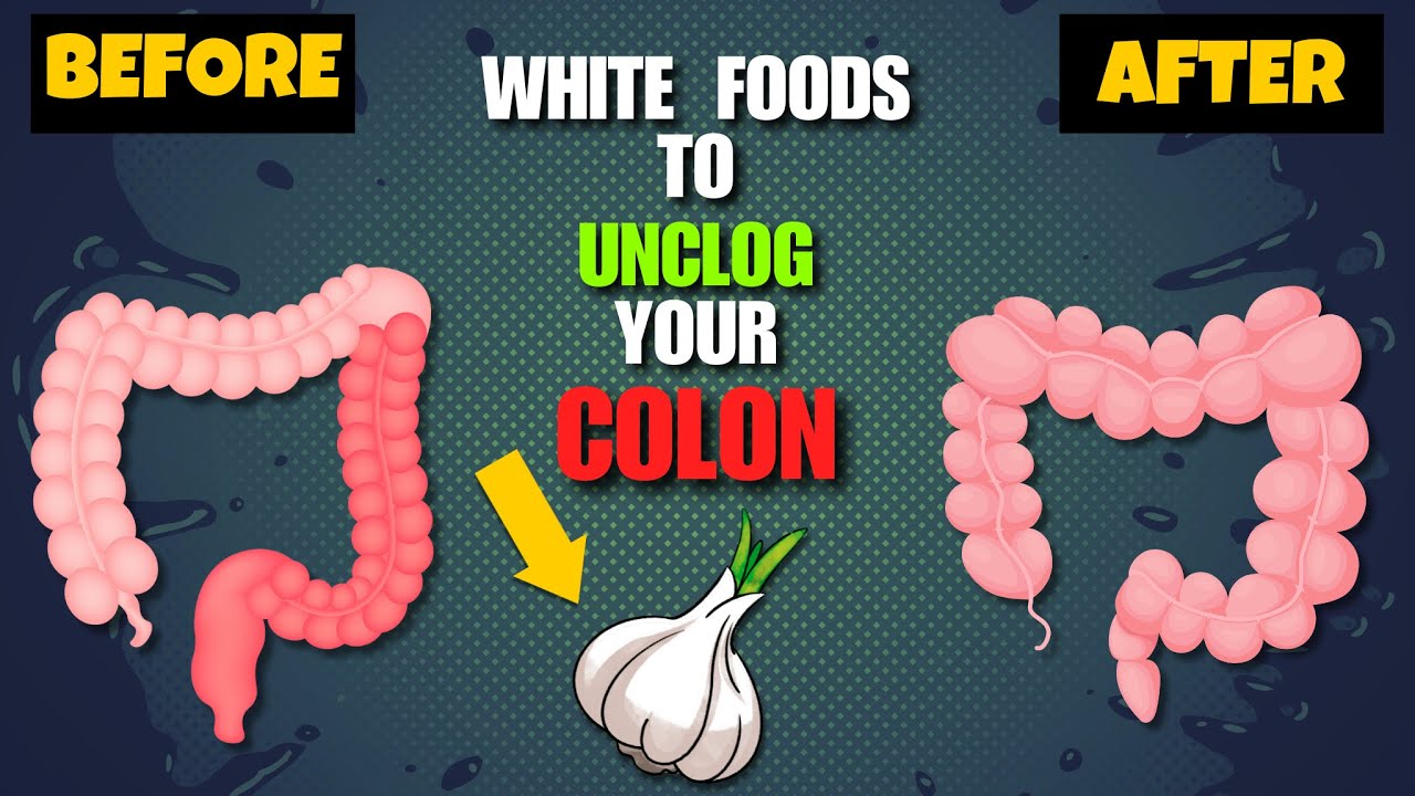 8 White Foods To Unclog Your Colon Fast | Natural Colon Cleanse | WellNest