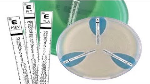 ETEST: Multi Pack Handling and Storage