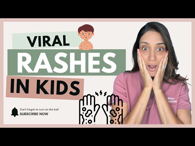 Rashes In Children Viral