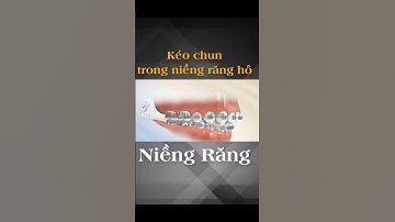 Kéo Thun Khi Niềng Răng Hô | Niềng Răng Mắc Cài