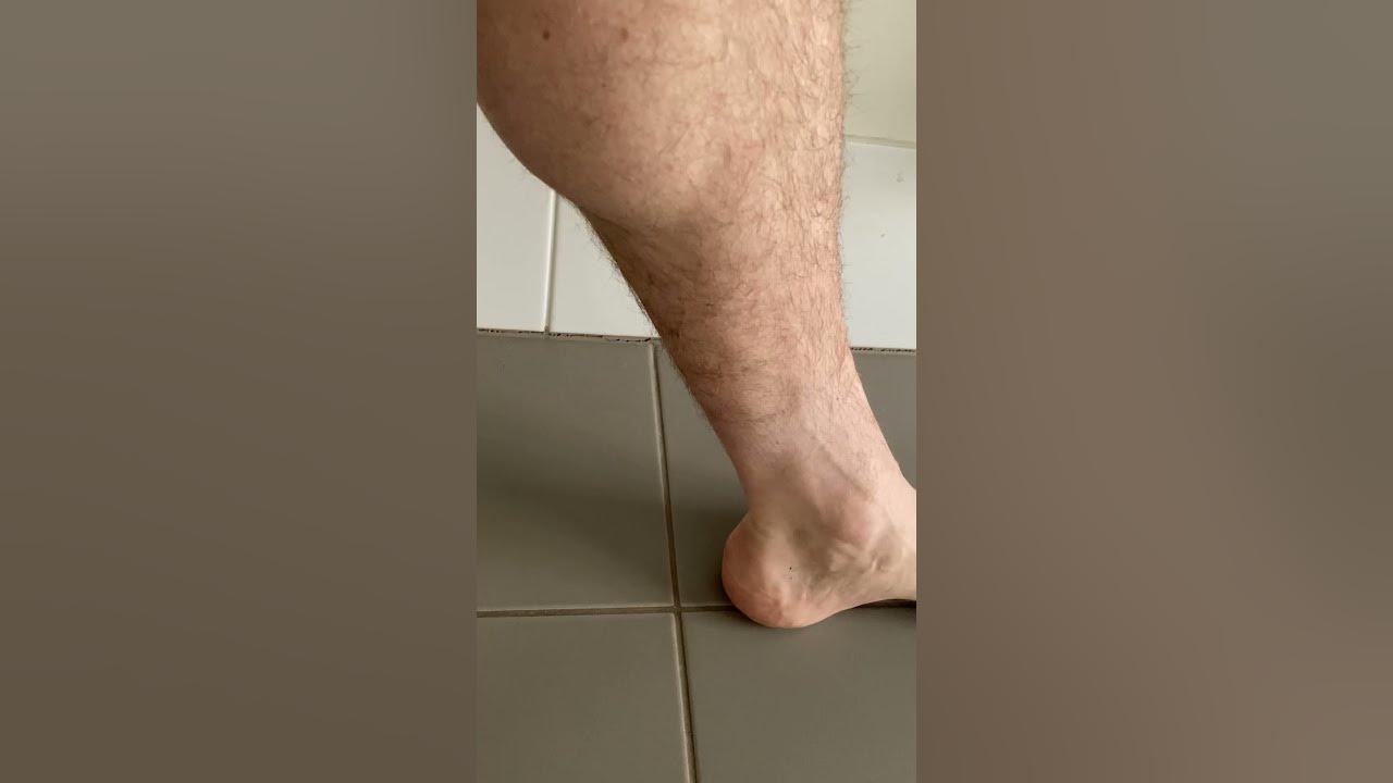 these-calf-muscle-twitches-cramps-and-spasms-look-like-little