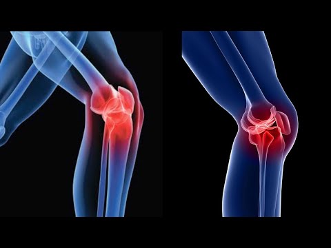 7 Ways To Heal Knee Pain Naturally!