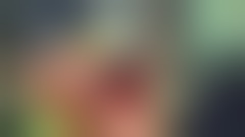 Innomed Tibial Knee Component Extractor