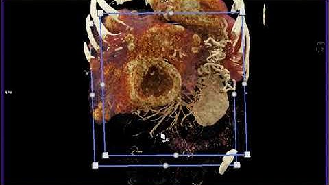 PNET with Cinematic Rendering