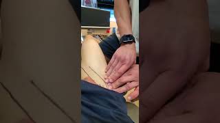Knee - Assessment - Functional Palpation Quadriceps Vastus Intermedius