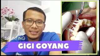 PERAWATAN GIGI GOYANG