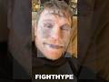 CANELO BATTERED &amp; BRUISED ZOMBIE NINJA; LETS DAUGHTER PAINT HIS FACE FOR HALLOWEEN 2023 OUTFIT