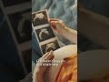 IVF doesn't happen in a single step