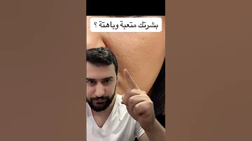 بشرتك تعبانة باهتة وبدون نضارة الحل سهل 