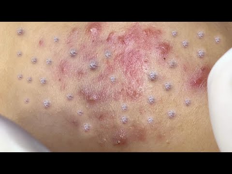 Satisfying Relaxing with Sac Dep Spa Video (#182)