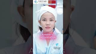VIET MY PLASTIC SURGERY HOSPITAL OFFERS 50% SUBSIDY FOR ULTHERAPY PRIME – FROM ONLY 42K/LINE