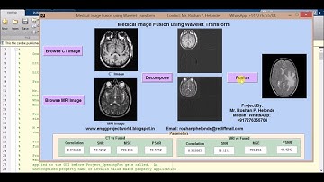 Matlab code for Medical Image Fusion using Wavelet Transform