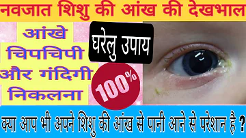 बच्चे की आँखों से पानी आ रहा है ?  | Baby Eye Care Tips | छोटे बच्चों की आँखों की देखभाल कैसे करे