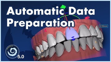 BSP5.0: From Scan to Setup in Minutes: Automatic Aligner Data Preparation With a Single Click!