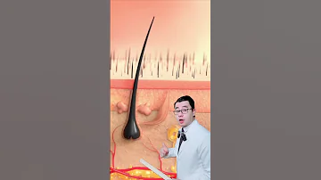 ازالة الشعر بالشمع 