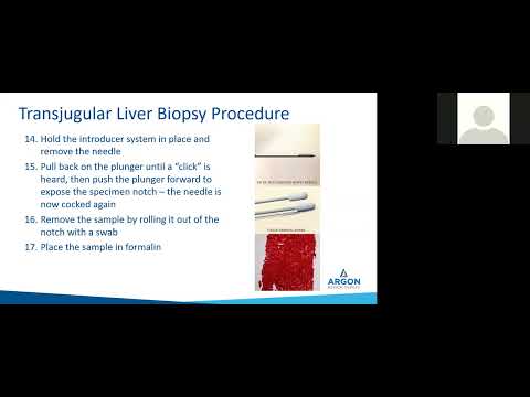 Transjugular Liver Biopsy Procedure and Argon Medical&rsquo;s TLAB Tricks & Tips