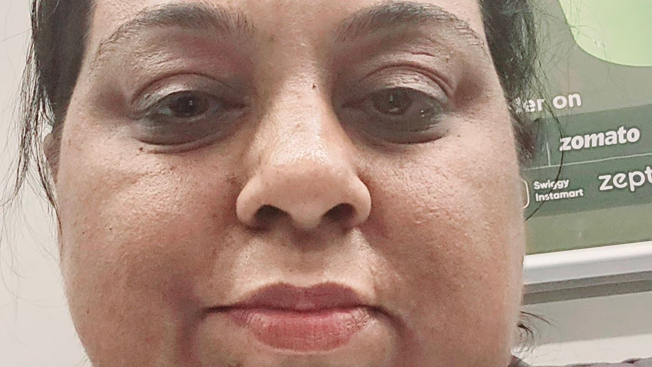 First interested case !