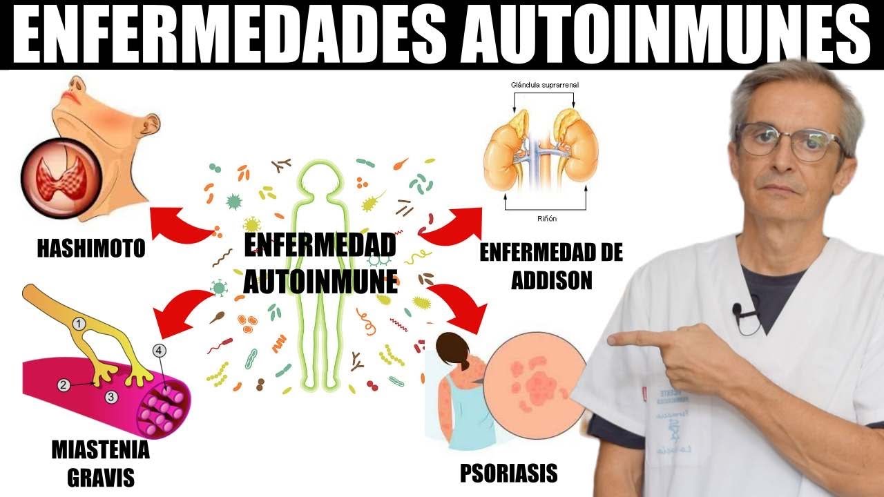 Que enfermedad inventar para faltar al trabajo