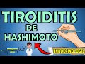 TIROIDITIS DE HASHIMOTO Síntomas, Causas, Diagnóstico y Tratamiento: RESUMEN 📝👨🏻‍⚕️