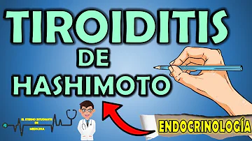 ¿Cómo diferenciar el hipotiroidismo del síndrome de Hashimoto?