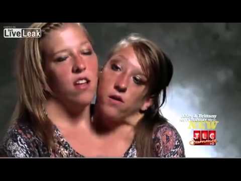 Две девочки с Oдним телом! Невероятно! - YouTube