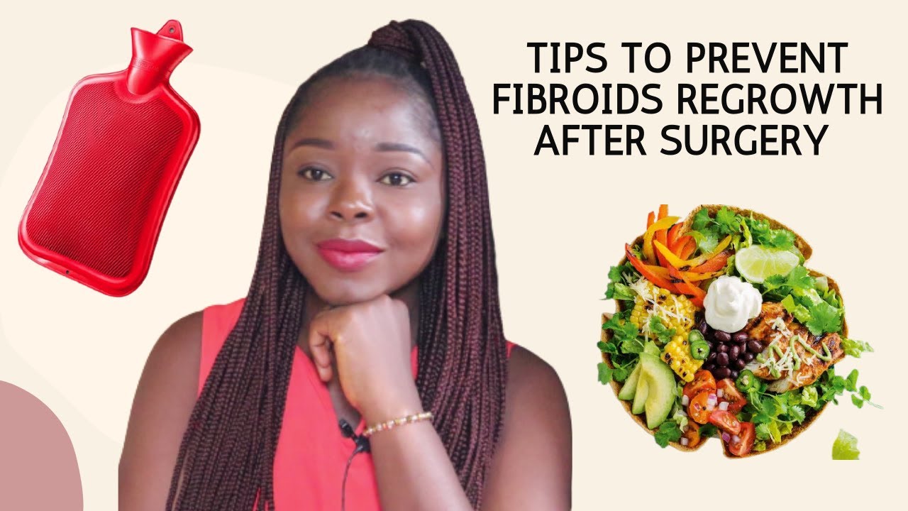 How To Prevent Fibroids Regrowth After A Myomectomy