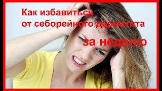 видео: Себорейный дерматит как избавиться за неделю! картинка: Себорейный дерматит как избавиться за неделю!