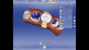 CEREC TiBase Crown Design @ 8x Speed