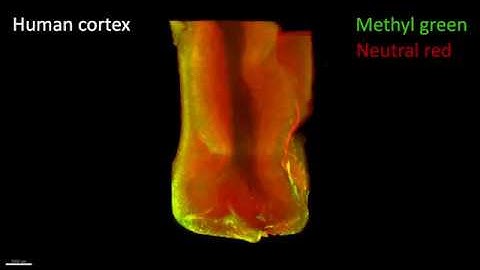 Imaging human cortex with a mesoSPIM