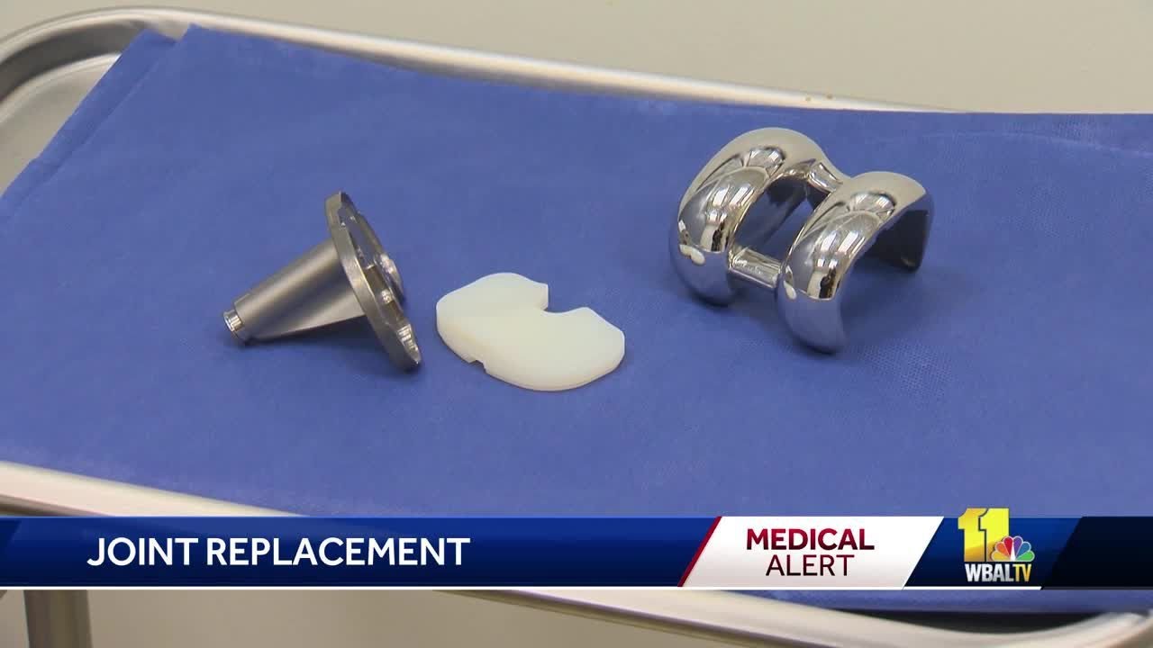 wbal-tv baltimore Woman's Doctor answers questions about joint replacement