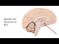 VIRTUAL FLASH CARDS - Anatomy of the BRAIN Model for Final Practical Exam UPDATED - 5-10-2023