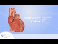 Heart Conditions – Atrial Septal Defect (ASD)