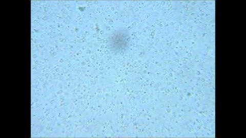 Coefficient of diffusion - Brownian motion