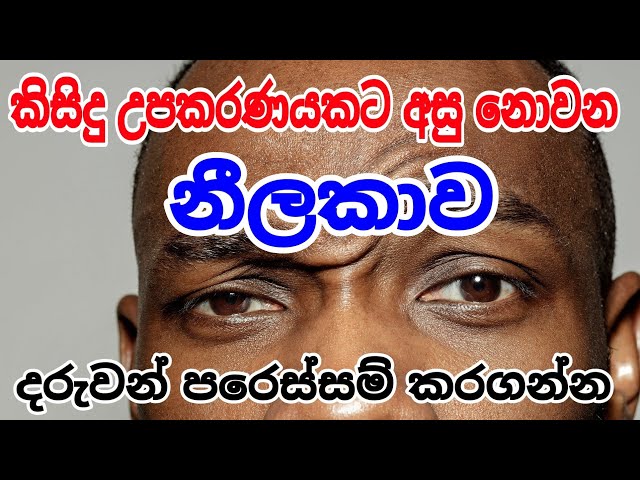 දරුවන් ප්‍රවේශම් කරගන්න,, කිසිඳු උපකරණයකට හසු නොවන රෝග, #siwhelatv