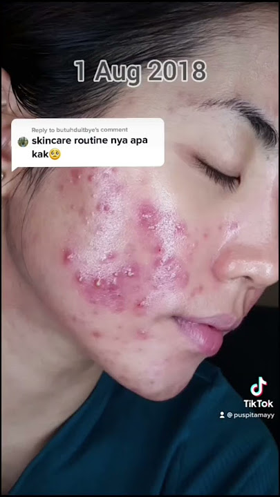2018 pernah separah ini 🥺🥺